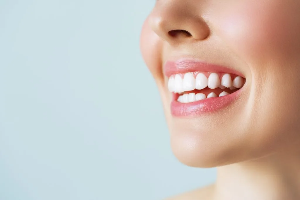 A woman's smile after smile makeover