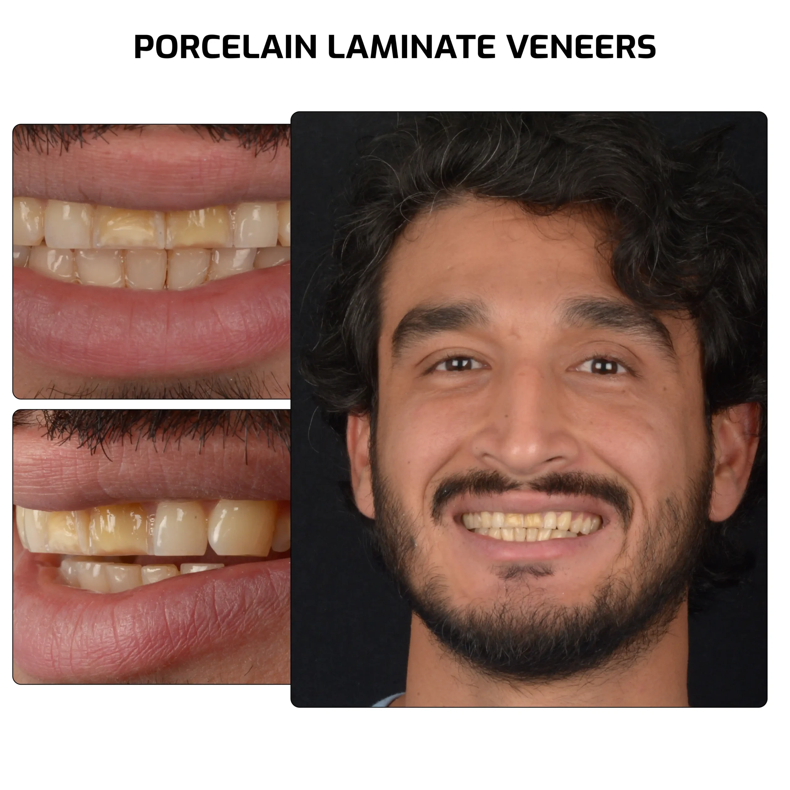 tedavi adi ahmed rashid rezwan 01 scaled